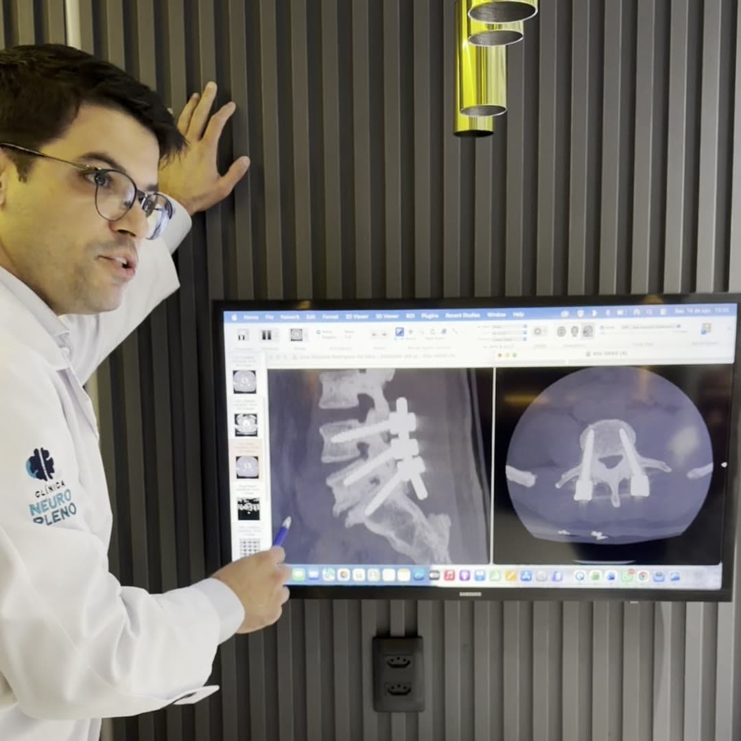 Cirurgia de Coluna